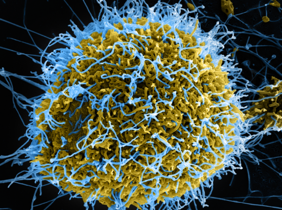 Single-cell study of Ebola highlights virus’s lethal maneuvers