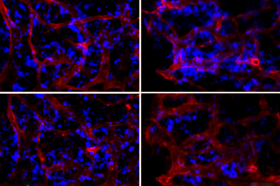 MIT researchers have shown they can deliver RNAi nanoparticles to the bone marrow, influencing their function