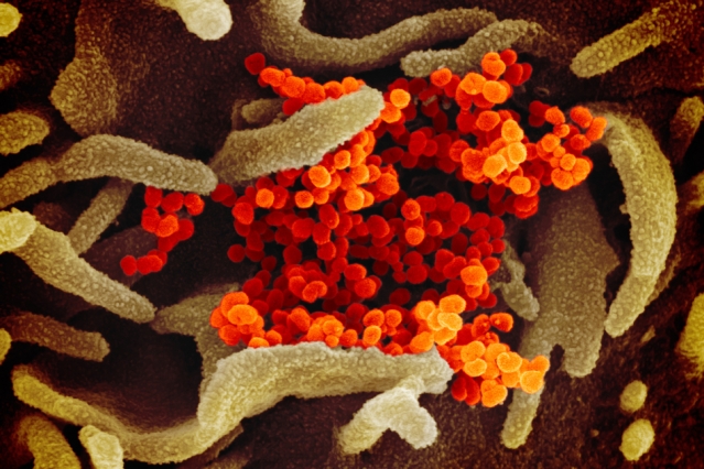 tudy finds specific cells in the lungs, nasal passages, and intestines that are more susceptible to infection.