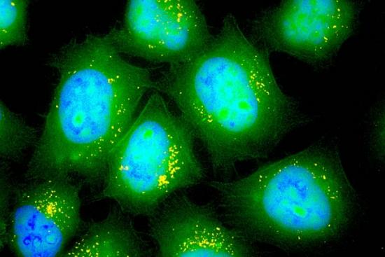 MIT researchers have designed inhalable particles that can deliver messenger RNA. These lung epithelial cells have taken up particles (yellow) that carry mRNA encoding green fluorescent protein. Image: Asha Patel