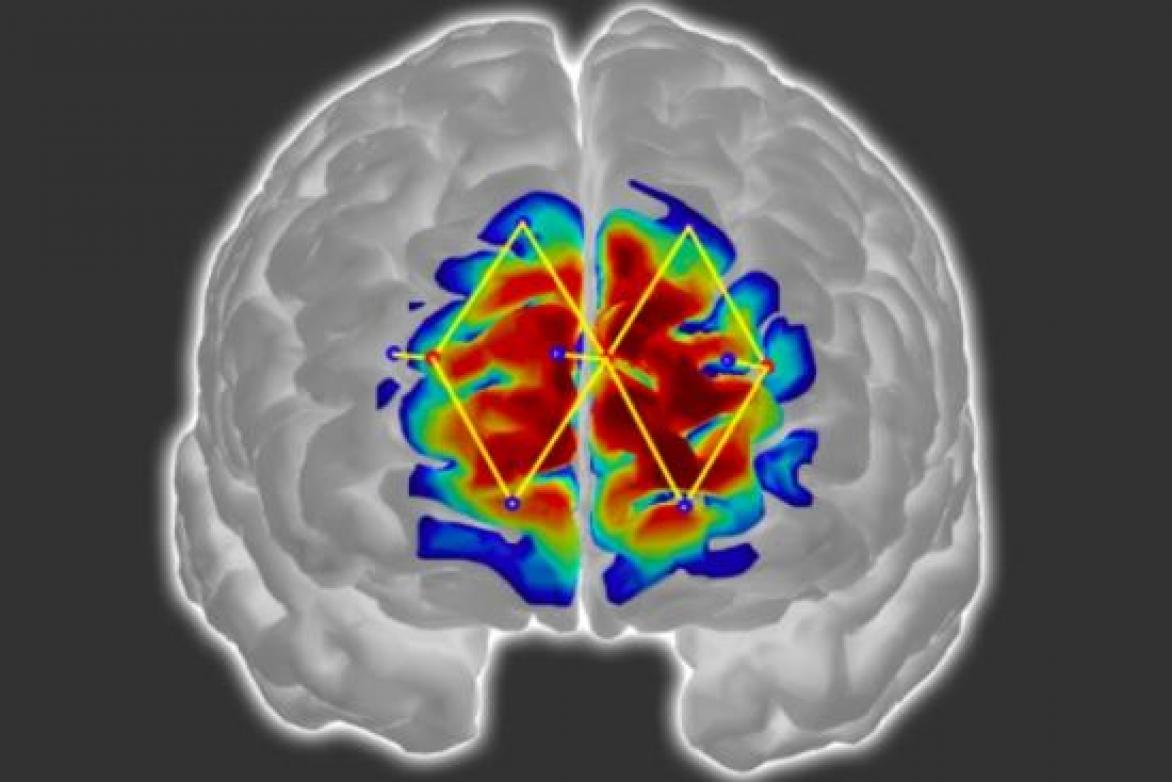 Detecting patients’ pain levels via their brain signals | Harvard-MIT ...