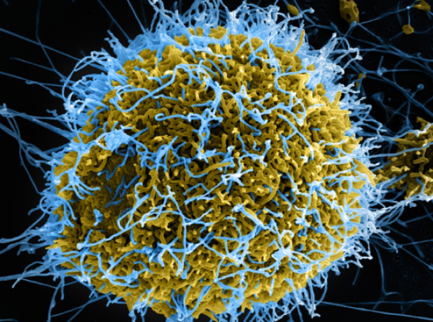 Single-cell study of Ebola highlights virus’s lethal maneuvers