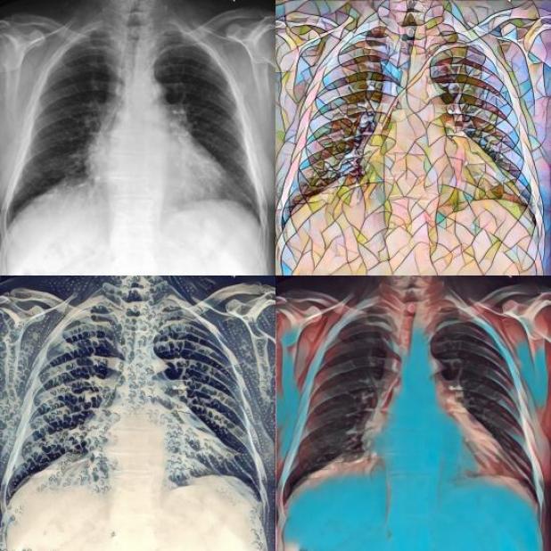 MIMIC-CXR-Image