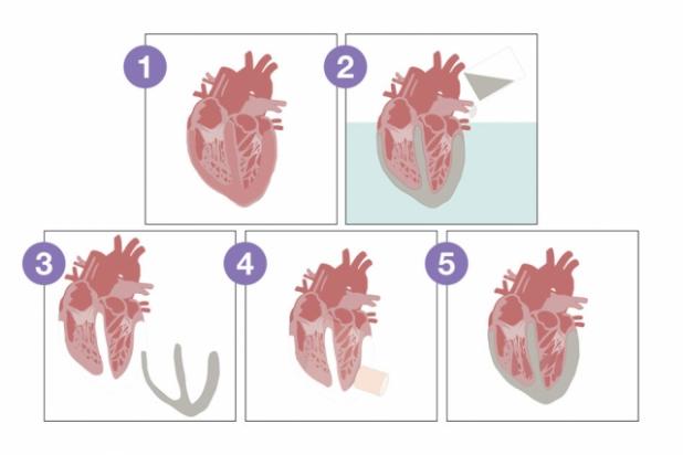 Depiction of biorobotic heart