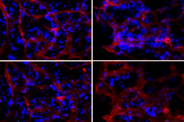 MIT researchers have shown they can deliver RNAi nanoparticles to the bone marrow, influencing their function