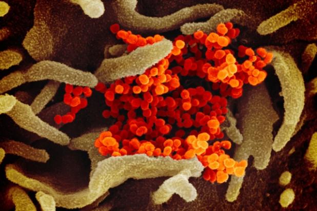tudy finds specific cells in the lungs, nasal passages, and intestines that are more susceptible to infection.