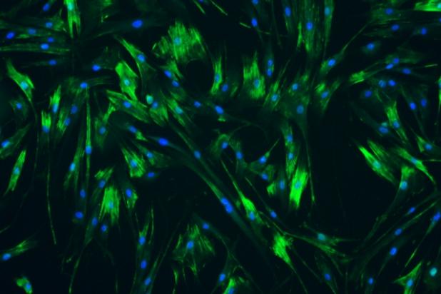 human ureteral smooth muscle cells
