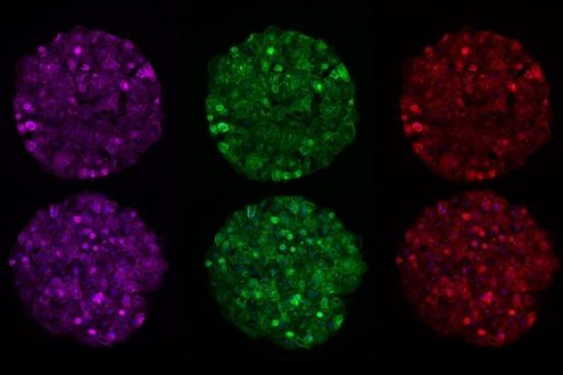 MIT researchers have developed an engineered liver tissue model that can be manipulated with RNA interference (RNAi). Credit: Liliana Mancio-Silva