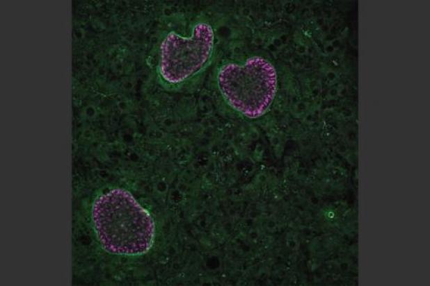 MIT-Malaria-Dormancy_0