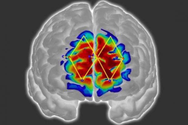 System could help with diagnosing and treating noncommunicative patients.