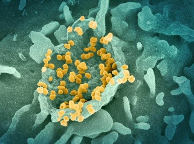 SARS research (Alex Shalek)