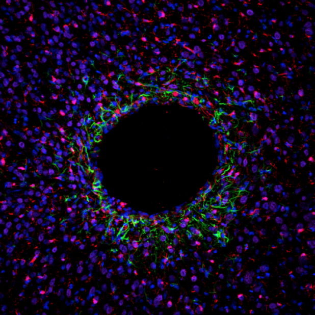 Photo: MiNDS probes cause minimal injury to brain tissue. This picture shows minimal tissue scarring (green and red stains) and healthy neuron growth (purple) surrounding the implant. Credit: Khalil Ramadi