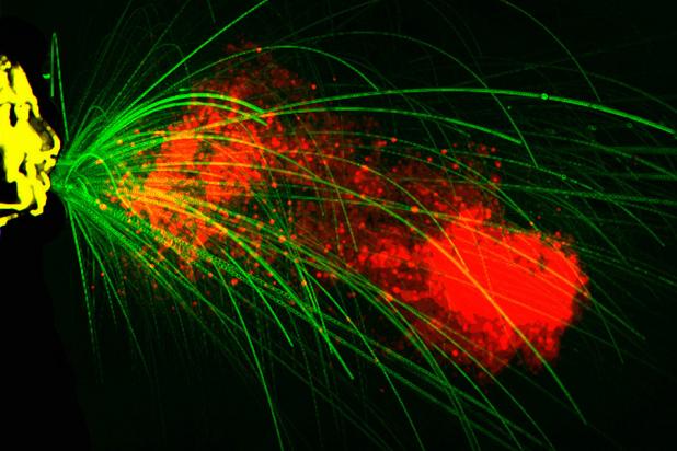 Anatomy of a sneeze