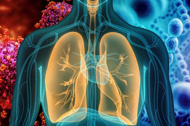 Sangeeta Pneumonia sensor