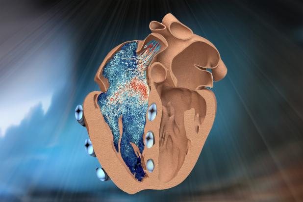 Robotic replica of right heart