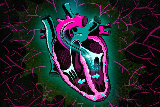 Ventricular research