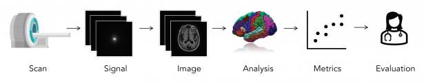 Machine learning report