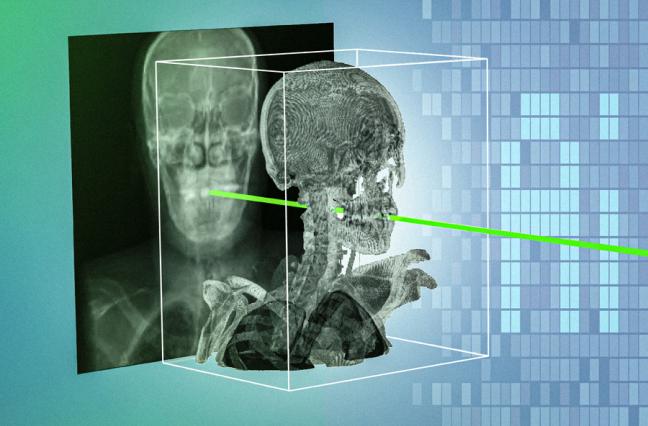 AI Model