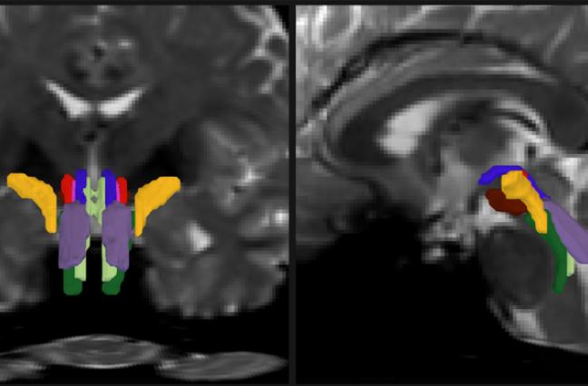 Emery Brown Mark Olychanyi research