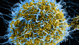 Single-cell study of Ebola highlights virus’s lethal maneuvers