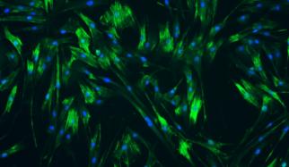 human ureteral smooth muscle cells