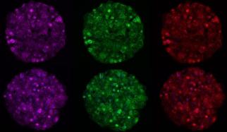 MIT researchers have developed an engineered liver tissue model that can be manipulated with RNA interference (RNAi). Credit: Liliana Mancio-Silva