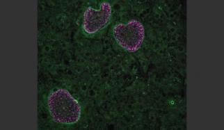 MIT-Malaria-Dormancy_0