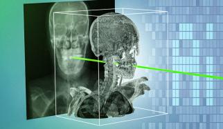 AI Model