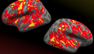 Brain regions that grew significantly thicker in reading-disabled children whose reading improved after an intensive summer treatment program, as shown in the red and yellow areas. Neither a control group nor children who did not respond to treatment exhibited changes in brain structure.” Image: Rachel Romeo