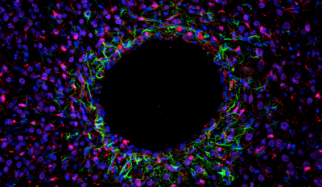 Photo: MiNDS probes cause minimal injury to brain tissue. This picture shows minimal tissue scarring (green and red stains) and healthy neuron growth (purple) surrounding the implant. Credit: Khalil Ramadi
